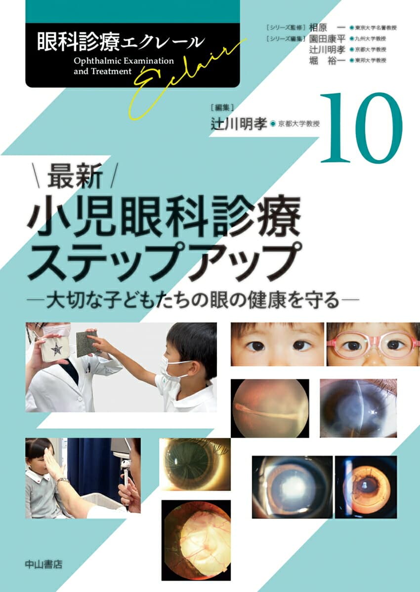 最新 小児眼科診療ステップアップ(第10巻) 大切な子どもたちの眼の健康を守る (眼科診療エクレール)